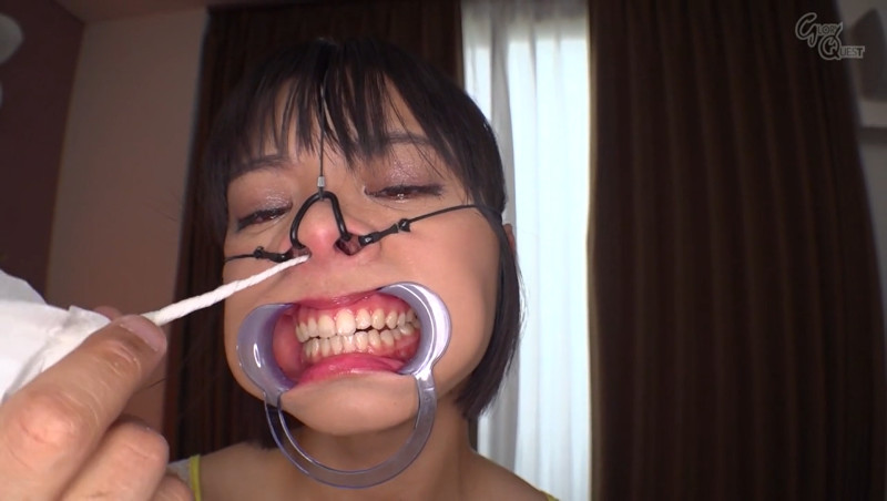 もなみ鈴 3点鼻フック 開口器 ティッシュこより
