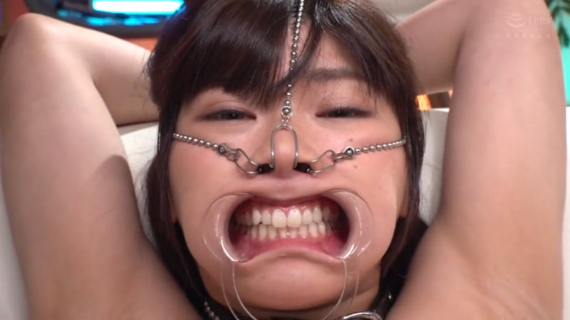 有加里 三方向鼻フック 開口器